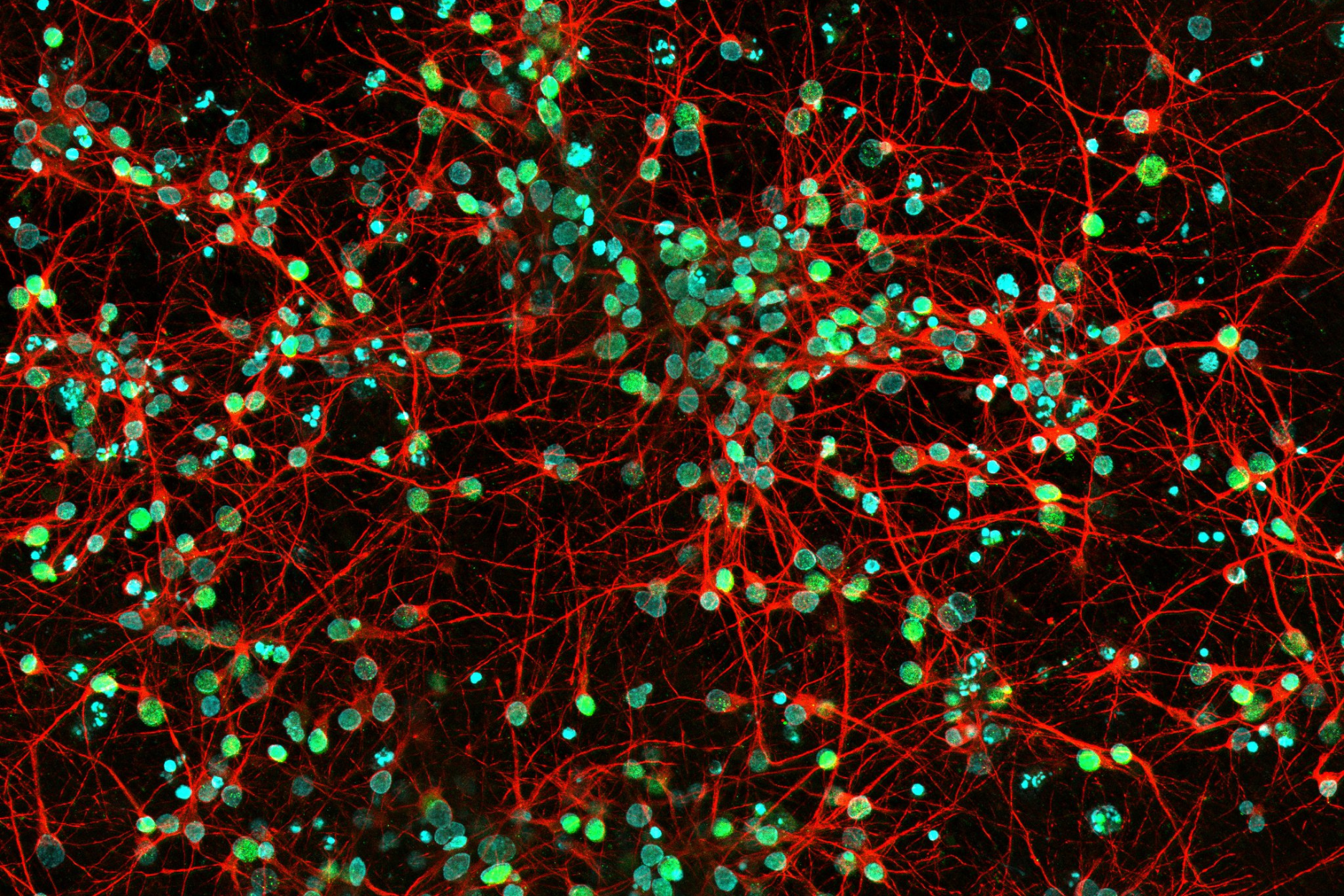 MAX_D161-30D-neurons-Brn2-Map2-B-R-Gagana