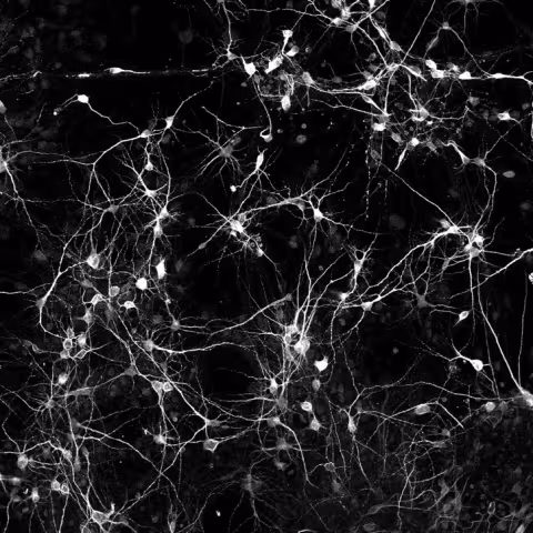neurons-firing